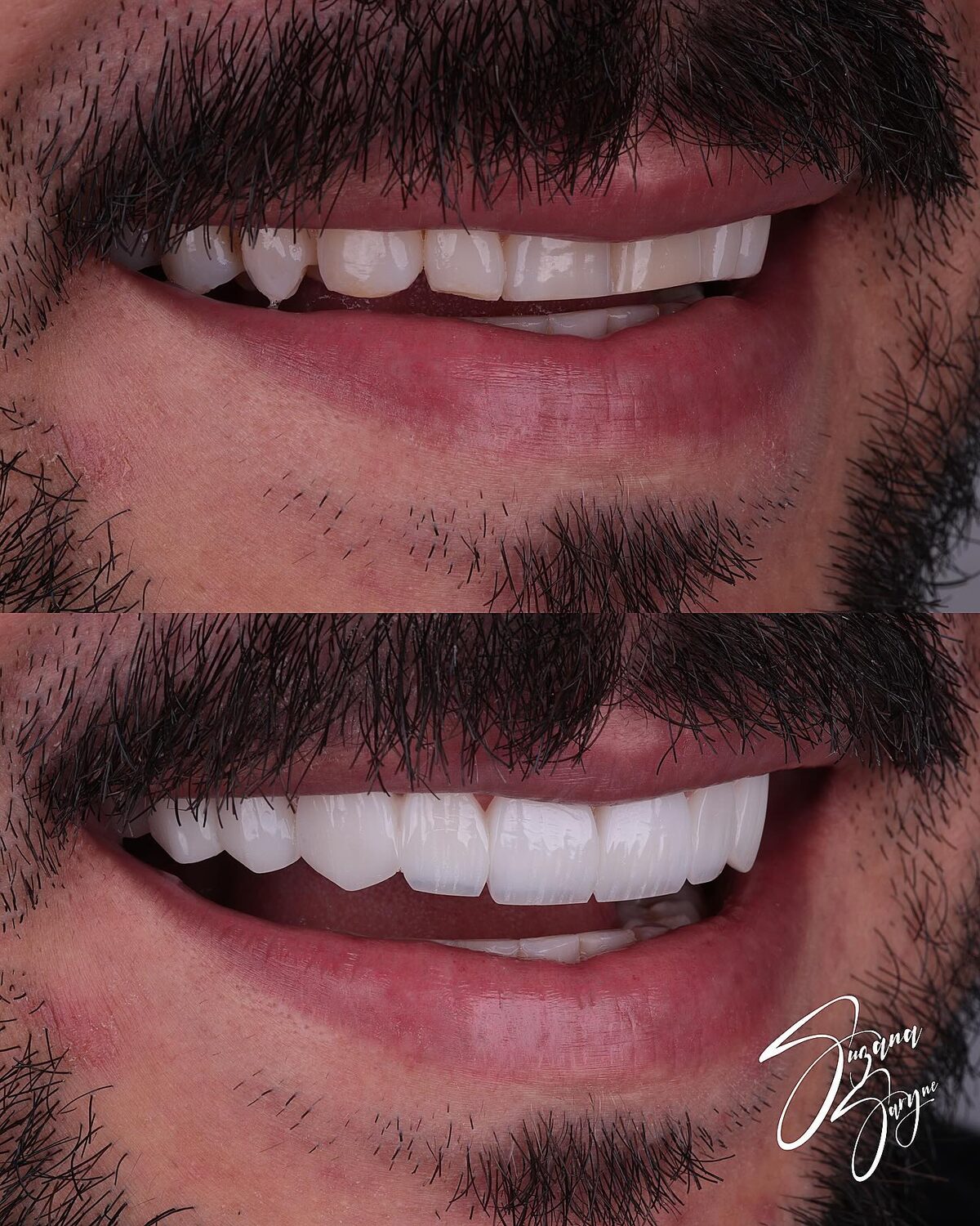 Caso 2 · reanatomização e alinhamento do sorriso — foto 3