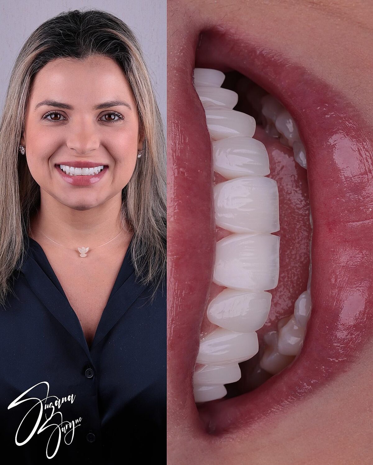 Caso 3 · fechamento de espaços e novo formato — foto 1