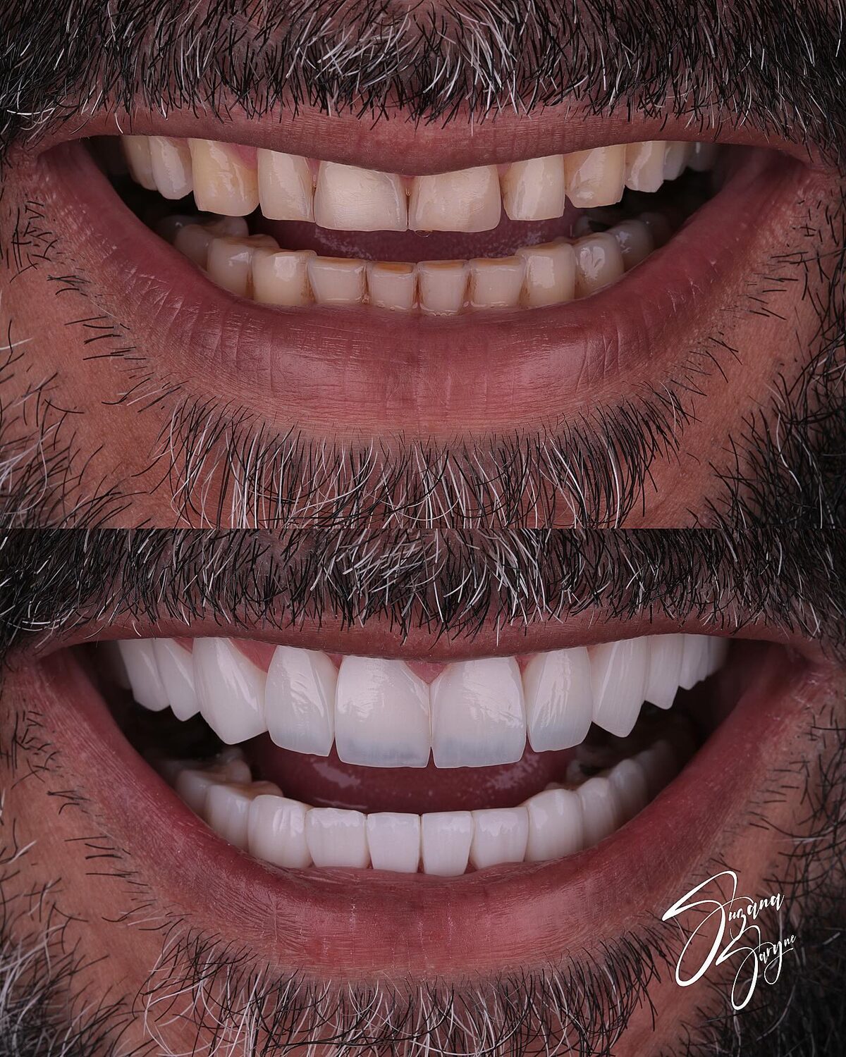 Caso 4 · renovação completa do sorriso — foto 2