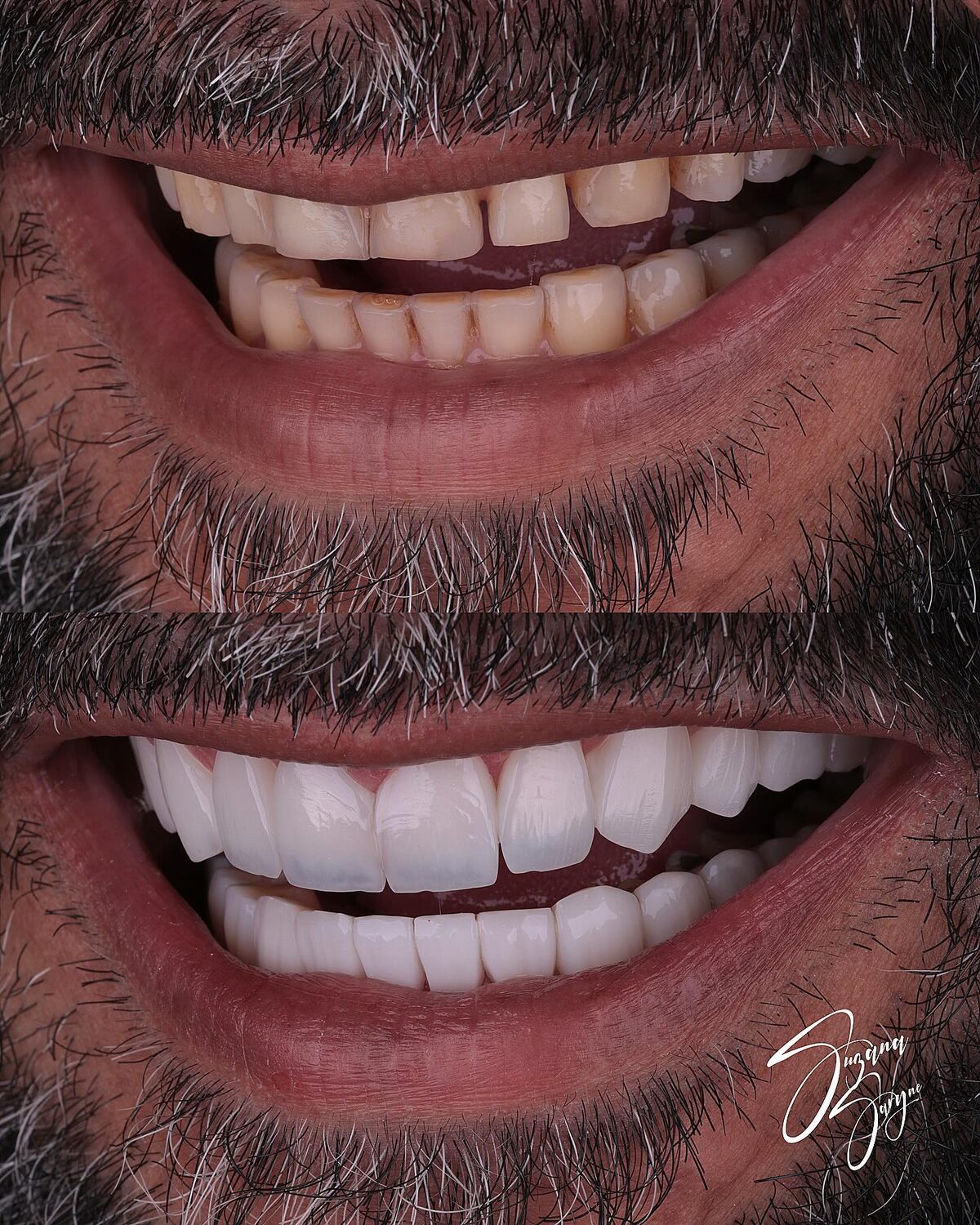Caso 4 · renovação completa do sorriso — foto 3