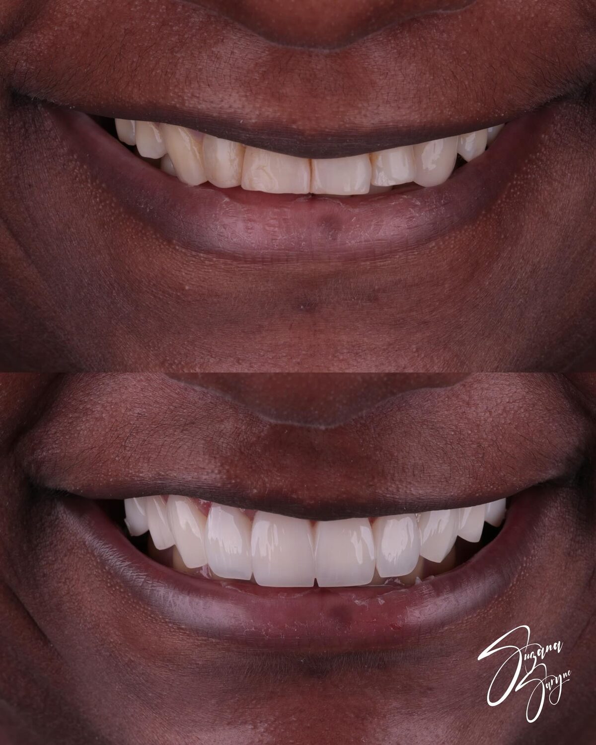 Caso 6 · transformação completa antes e depois — foto 2