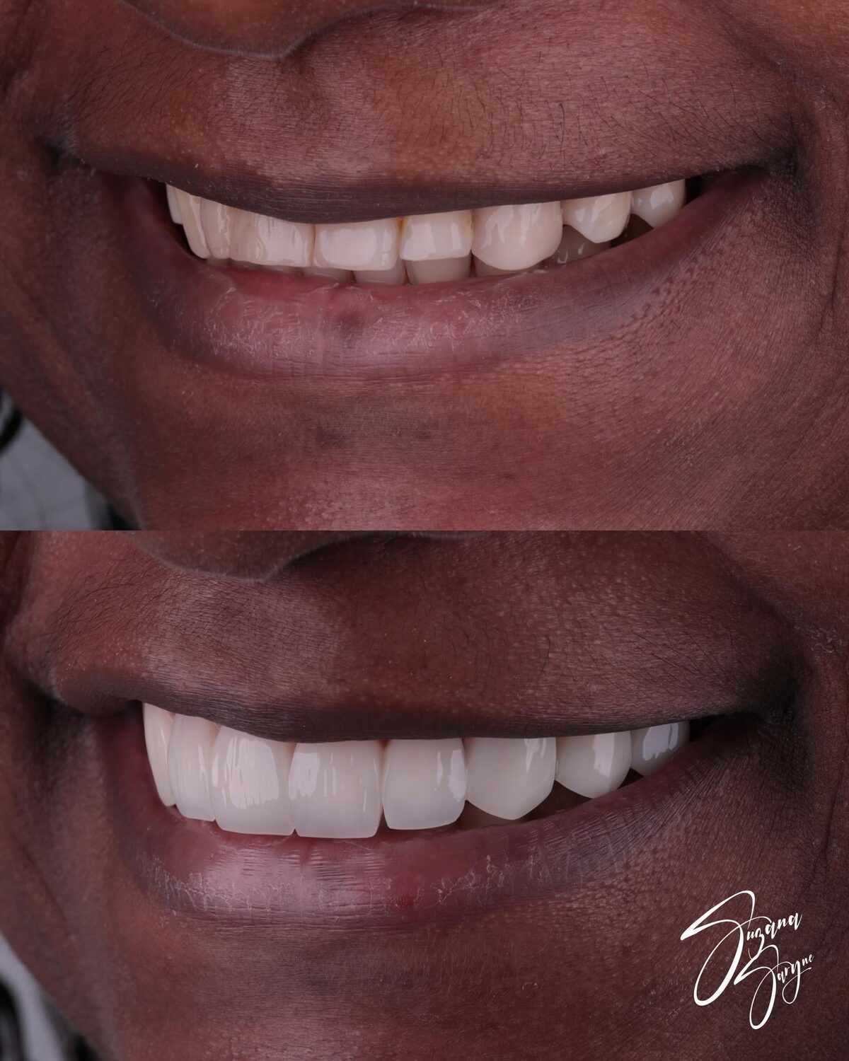 Caso 6 · transformação completa antes e depois — foto 3